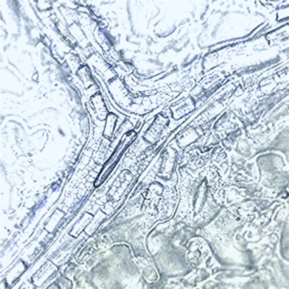 HPLC Molecular-Level  Standardization